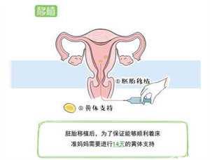 杭州试管婴儿生龙凤胎的几率（杭州一般医院助孕费用）